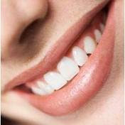 Tips Merawat Gigi Agar putih,Cara Merawat gigi