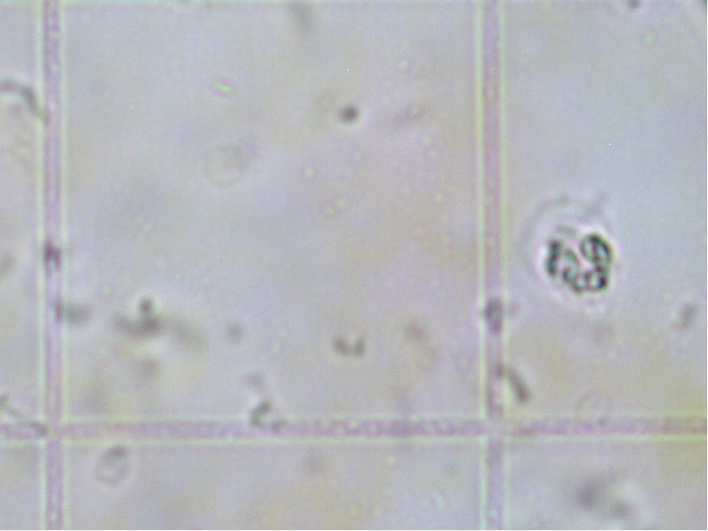 Nadi Biologi Leukosit  Menghitung Jumlah Leukosit  