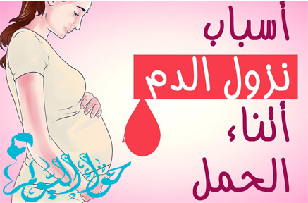 ما هي اسباب نزول الدم أثناء الحمل