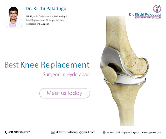  Best Knee Replacement 