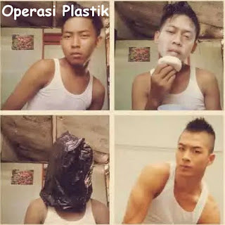 operasi-plastik