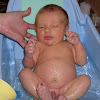 Circumcised Baby Bath : Circumcision In Baby Boys Babycentre Uk : The water should feel warm, not hot, when tested with your wrist.