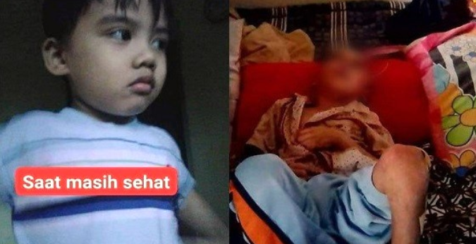  VIRAL  Bocah  7 Tahun di Bandung Diduga Dianiaya Orangtua 