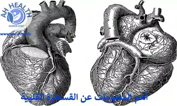 أهم المعلومات عن القسطرة القلبية