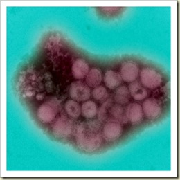 Virus suino