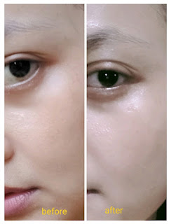 Before - After Skintific Serum