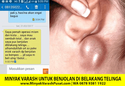 Testimoni Varash Classic Untuk benjolan di belakang telinga