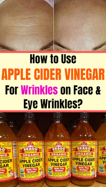 How to Use Apple Cider Vinegar for Wrinkles on Face & Eye Wrinkles?