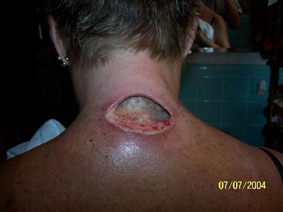Is A Huntsman Spider Bite Dangerous To Dogs : How to Get Rid of Wolf Spiders - RidMyCritters.com | Wolf ... : She was a beautiful, calm spider, not aggressive in any way and like most spiders she just wanted to go about her business eating bugs and living in peace.