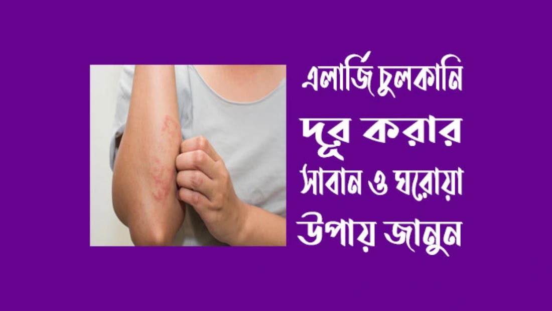 ছবি