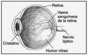 Problemas De La Vista Por Diabetes