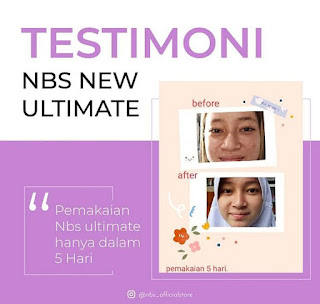 Testimoni NBS Skin Care Stockist Makassar