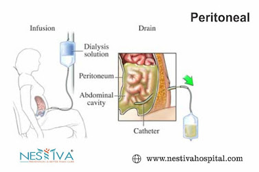 Peritoneal Dialysis