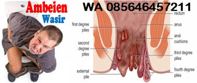 Salwa de Nature Nama Salep Ambeien Luar 