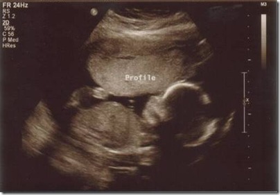1.25.11 ultrasound