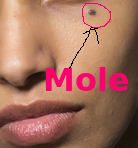 mole means a small dark spot or lump on skin