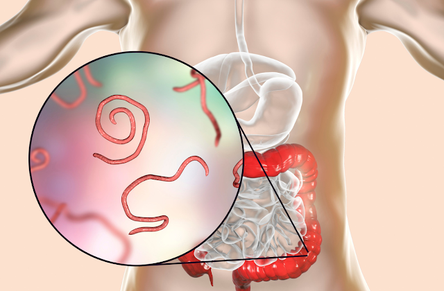 Découvrez 4 aliments naturels efficaces pour lutter contre les vers intestinaux