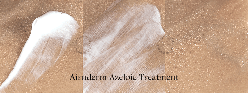review-airnderm-azeloic-treatment-&-hydrating-primer-toner