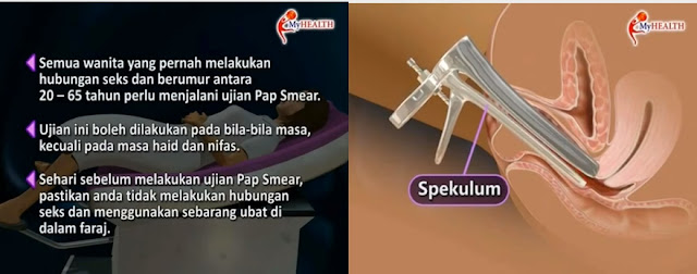 Amalini's diary: Pap Smear. Dah Buat Belum?