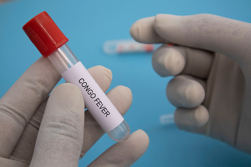 Crimean-Congo haemorrhagic fever (CCHF)