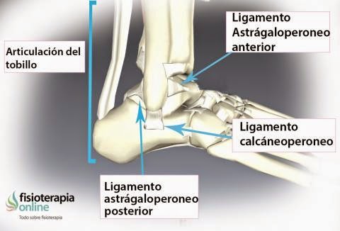 TRATAMIENTO ESGUINCE TOBILLO