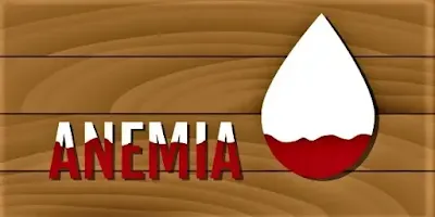 الأنيميا ( فقر الدم )