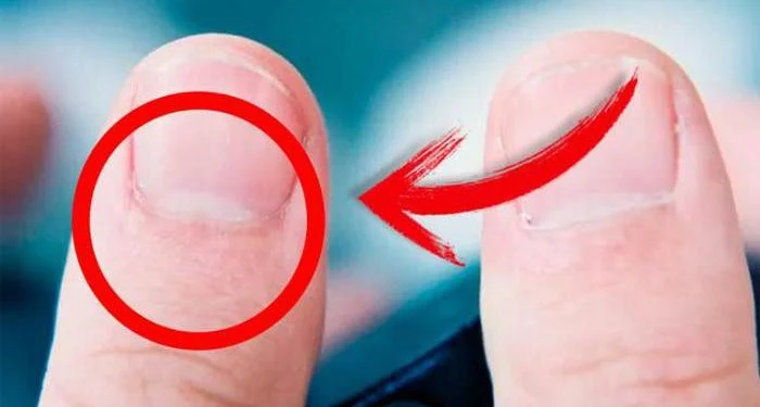 Half Moon Shape on Your Nails Mean