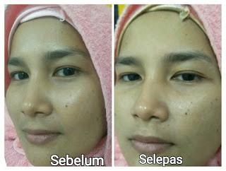 kursus spa, kursus mobile spa, TWB, The Walking Beauty, belajar spa, kursus berpantang, jana income, cari kerja, cari duit, youth shaklee