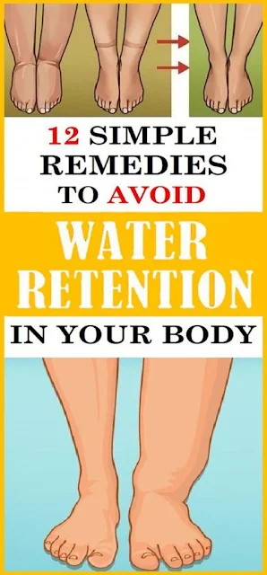 12 Simple Remedies To Avoid Water Retention In Your Body