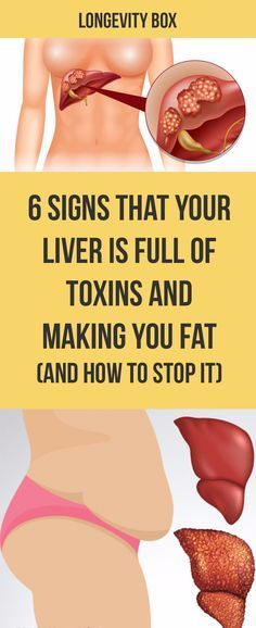 6 SIGNS THAT YOUR LIVER IS FULL OF TOXINS AND MAKING YOU FAT (AND HOW TO STOP IT)
