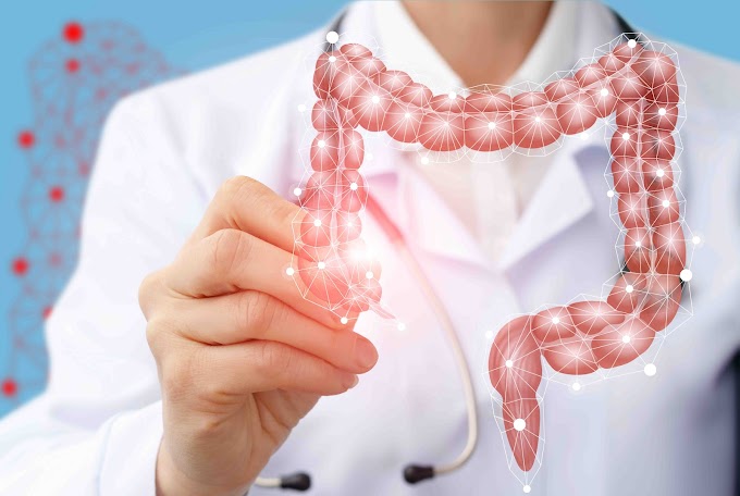6 consejos para prevenir el cáncer de colon