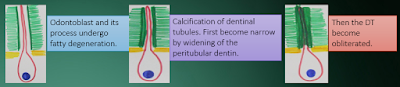 sclerotic dentin