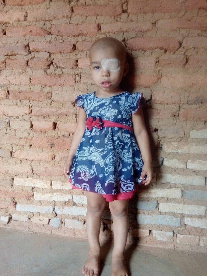 Campanha Solidária: Família De Criança Com Câncer No Olho Pede Ajuda Para Compra De Alimentos E Medicação Em Araripe.