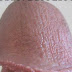Cara Mencegah Virus Hepatitis B thumbnail