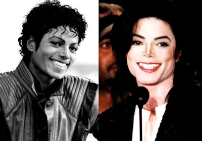 Michael Jackson con bella sonrisa antes y después