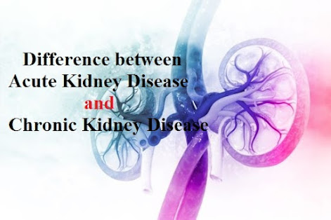 Difference Between Acute Kidney Disease and Chronic Kidney Disease