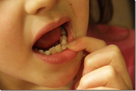 KyliesLostTooth-1