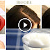 Thin and Bald Hair Magic!!! Grow Your Hair Fast Overnight With Only 1 Ingredients