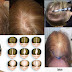 How To Stop Hair Loss And Grow Naturally Very Fast!