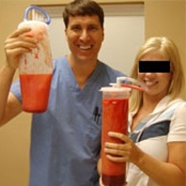 Liposculpture doctor Craig Alan Bittner pic