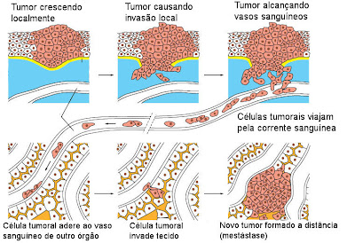 Câncer - como surgem as metástases