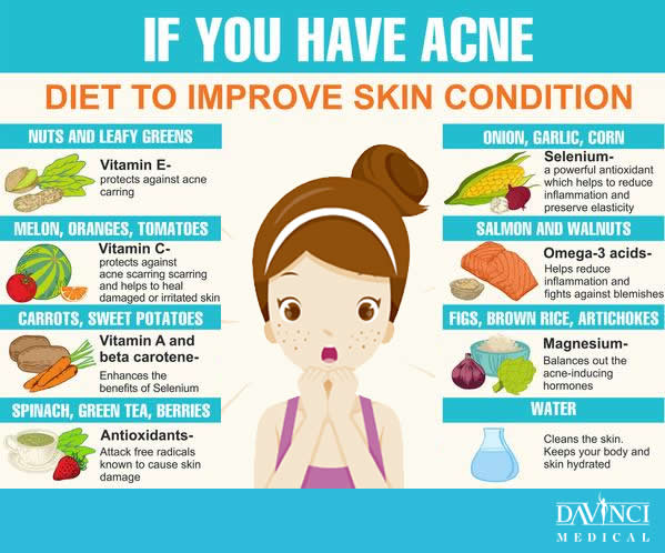 Diet to Improve Acne