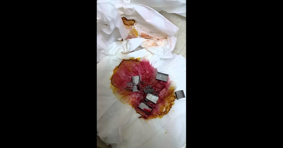 Ø¹Ù„Ø§Ù…Ø§Øª Ø®Ø±ÙˆØ¬ Ø§Ù„Ø³Ø­Ø± Ø§Ù„Ù…Ø£ÙƒÙˆÙ„ ÙˆØ§Ù„Ù…Ø´Ø±ÙˆØ¨ Ù…Ø¹ Ø§Ù„Ø¨Ø±Ø§Ø² Ø§ÙƒØ¨Ø± Ù…Ø¹Ø§Ù„Ø¬ Ù…ØºØ±Ø¨ÙŠ Ø¨Ø§Ù„ÙƒÙˆÙŠØª