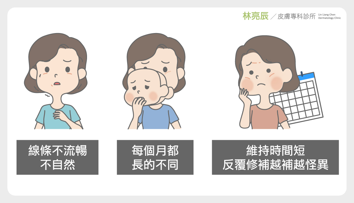 玻尿酸填充凹陷皺紋效果玻尿酸維持玻尿酸變形sculptra舒顏萃玻尿酸3D聚左旋乳酸液態拉皮童顏針新竹林亮辰醫師新竹3D聚左旋乳酸
