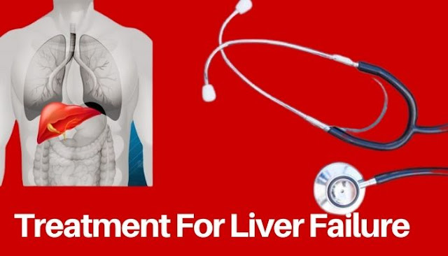 treatment for acute liver failure