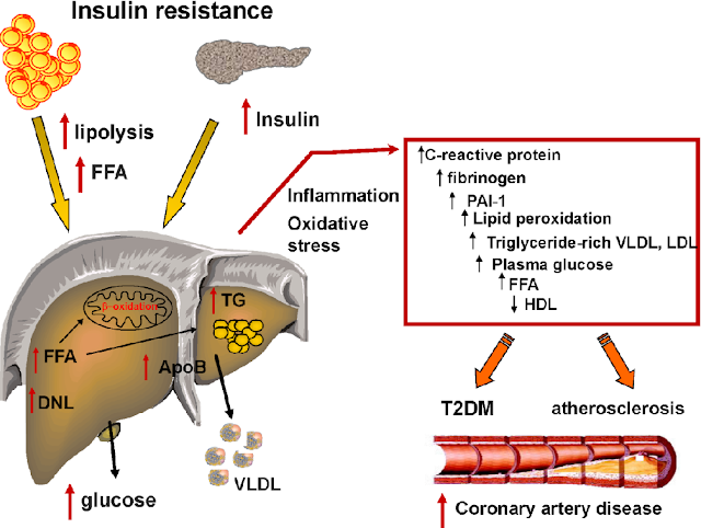 Non Alcoholic Fatty Liver Strategy Review: View These Articles-Offical Store!