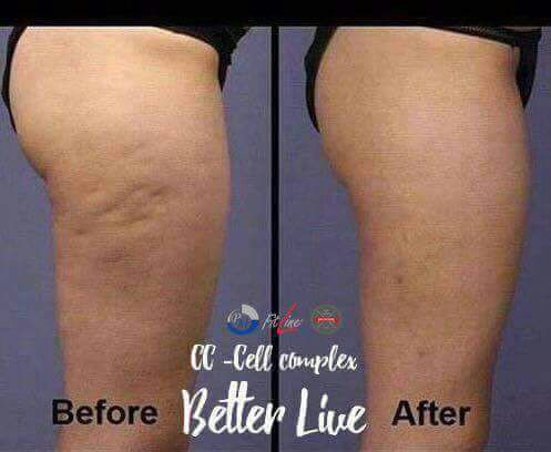 fitline cellulite