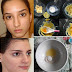 GET RID FROM PIMPLES AND ACNEES OVERNIGHT-DIY NATURAL