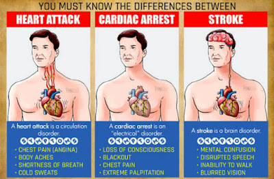 symptoms of heart attack , symptoms of cardiac arrest , symptoms of stroke