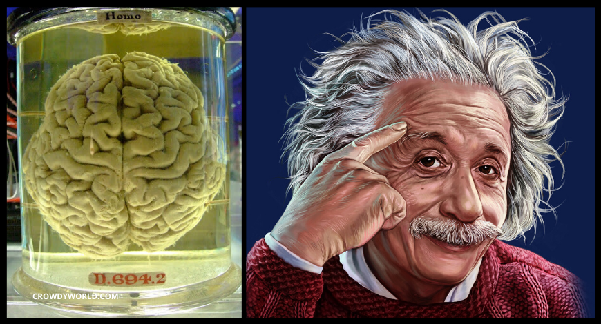 Why Einstein Brain Is Different And It Is Still Kept In Museum?